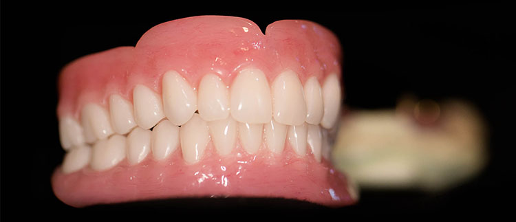 Dental Dentures in Coimbatore